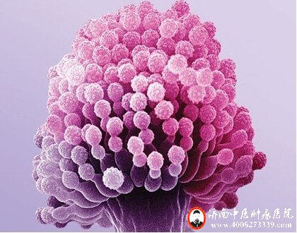 黄曲霉素